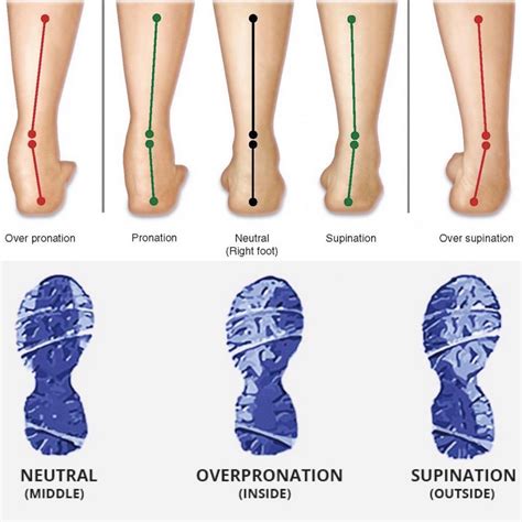 Overpronation Shoes 